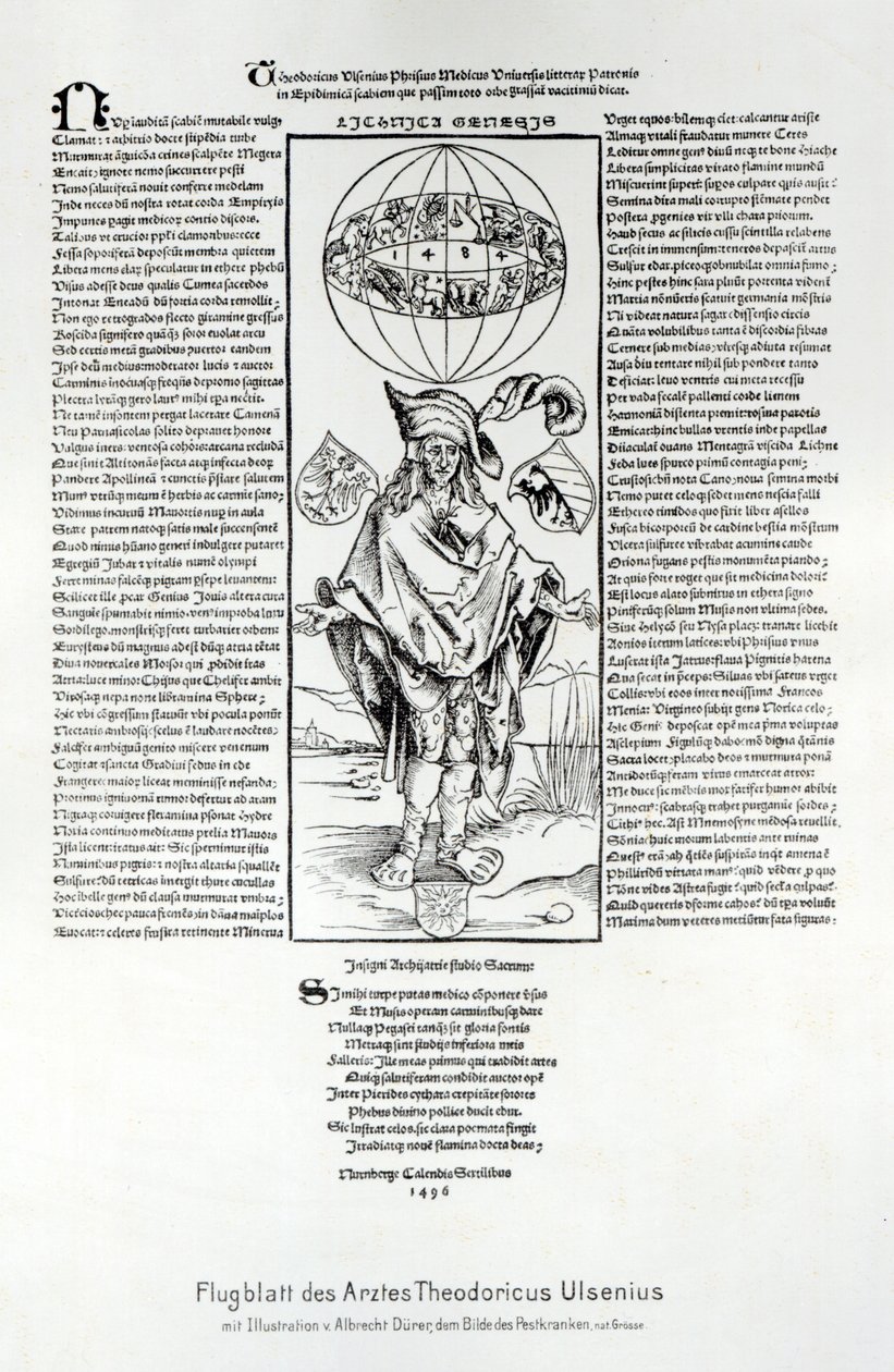 Illustration de la syphilis, 1496 - Albrecht Dürer
