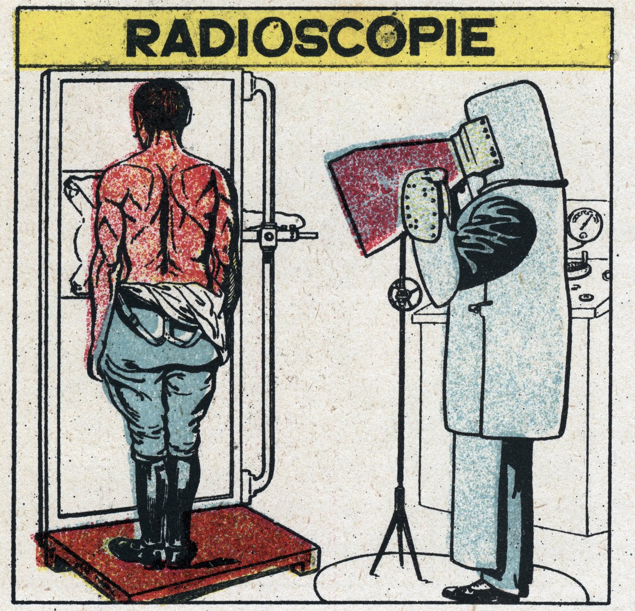 Rayons X : radioscopie d