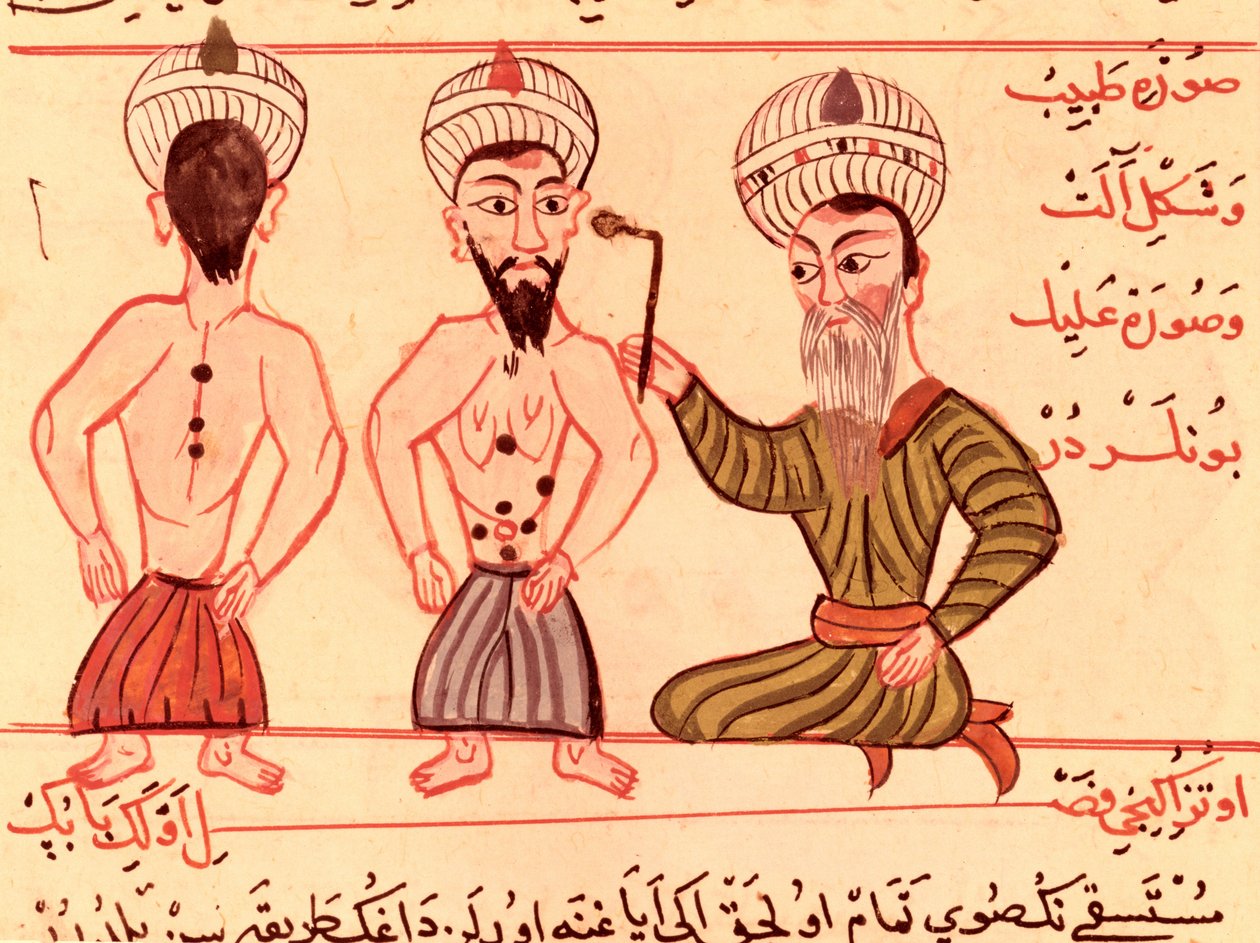 Ms Sup Turc 693 fol.35 Opération de cautérisation, 1466 - Charaf ed Din