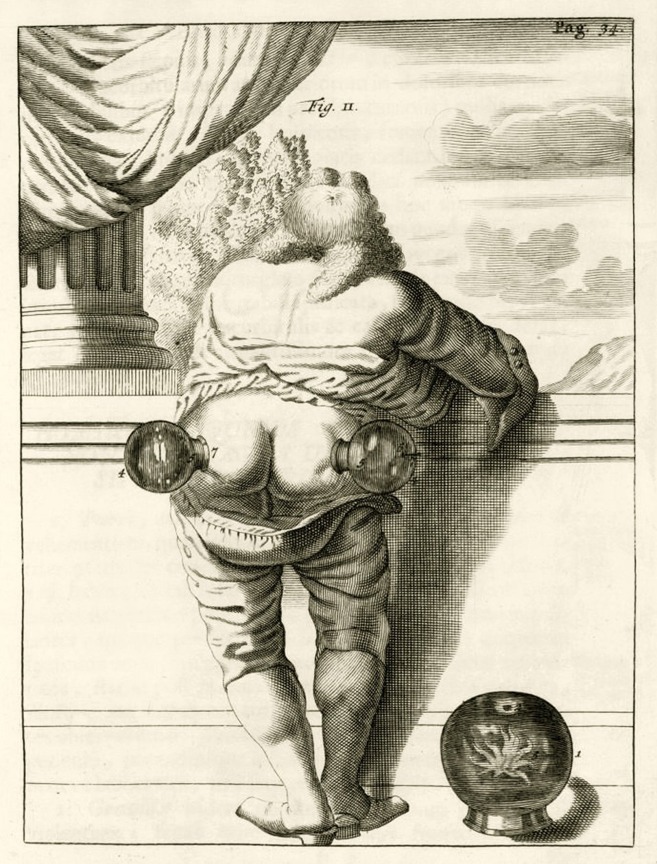 Un exemple de ventouses, de Exercitationes Practicae circa Medendi Methodum par Frederik Dekkers, 1694 - Dutch School