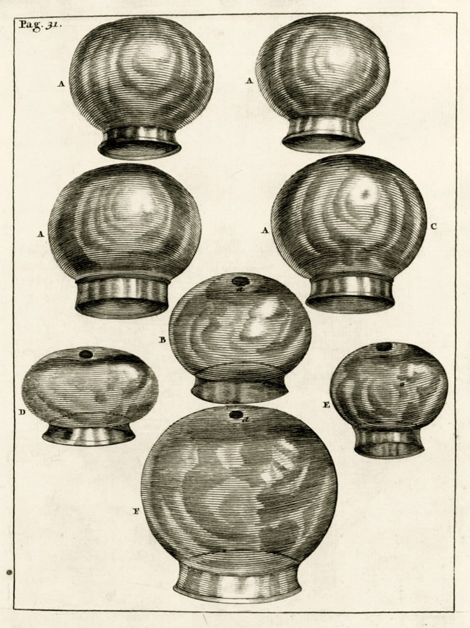 Divers verres à ventouses, de Exercitationes Practicae circa Medendi Methodum par Frederik Dekkers, 1694 - Dutch School