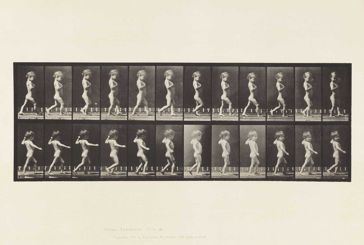 A, Jambes arquées; Garçon; B, Caries vertébrales; Fille marchant - Eadweard Muybridge