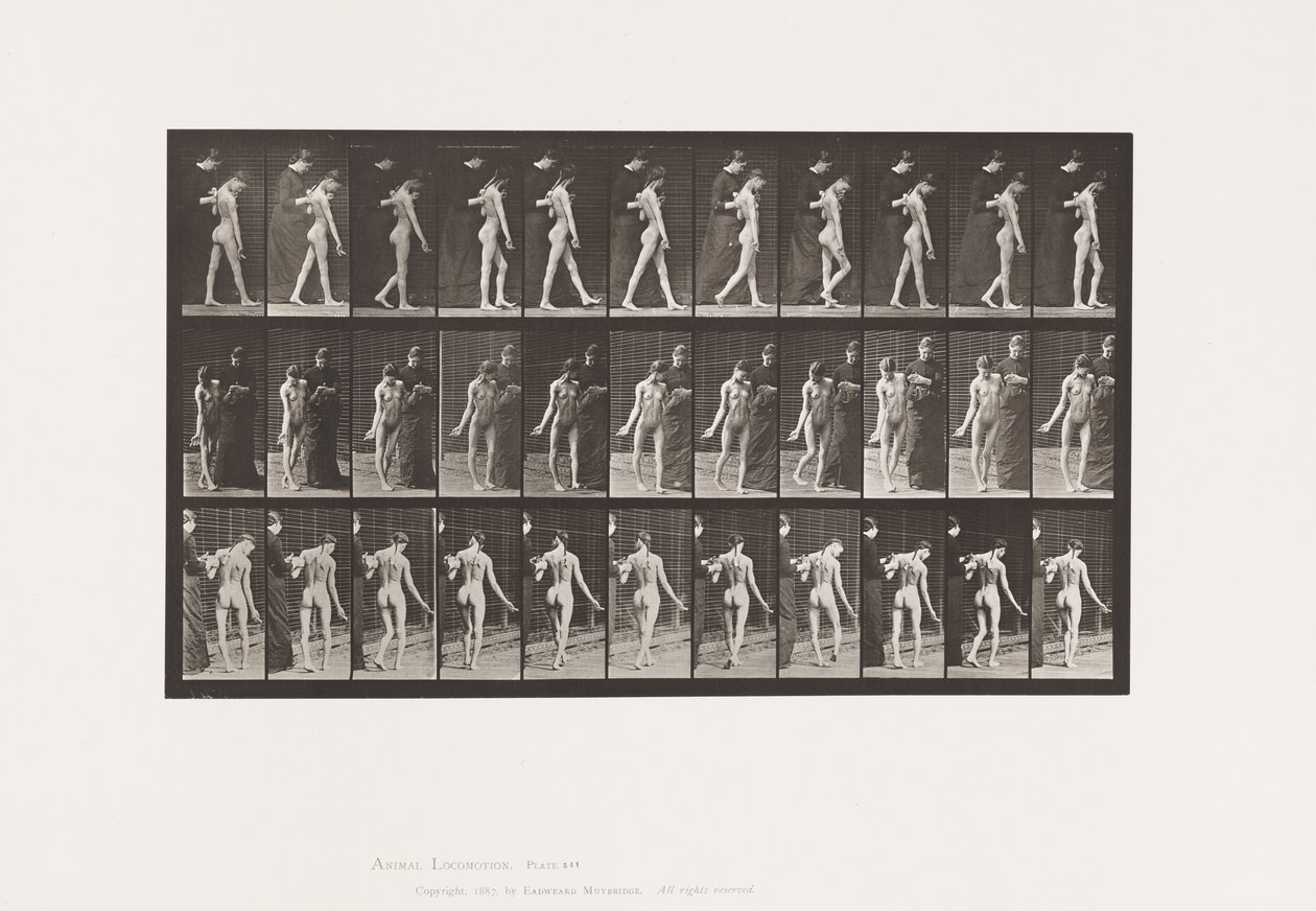 Planche 541. Sclérose Cérébro-Spinale Multiple (Choréique); Marche - Eadweard Muybridge