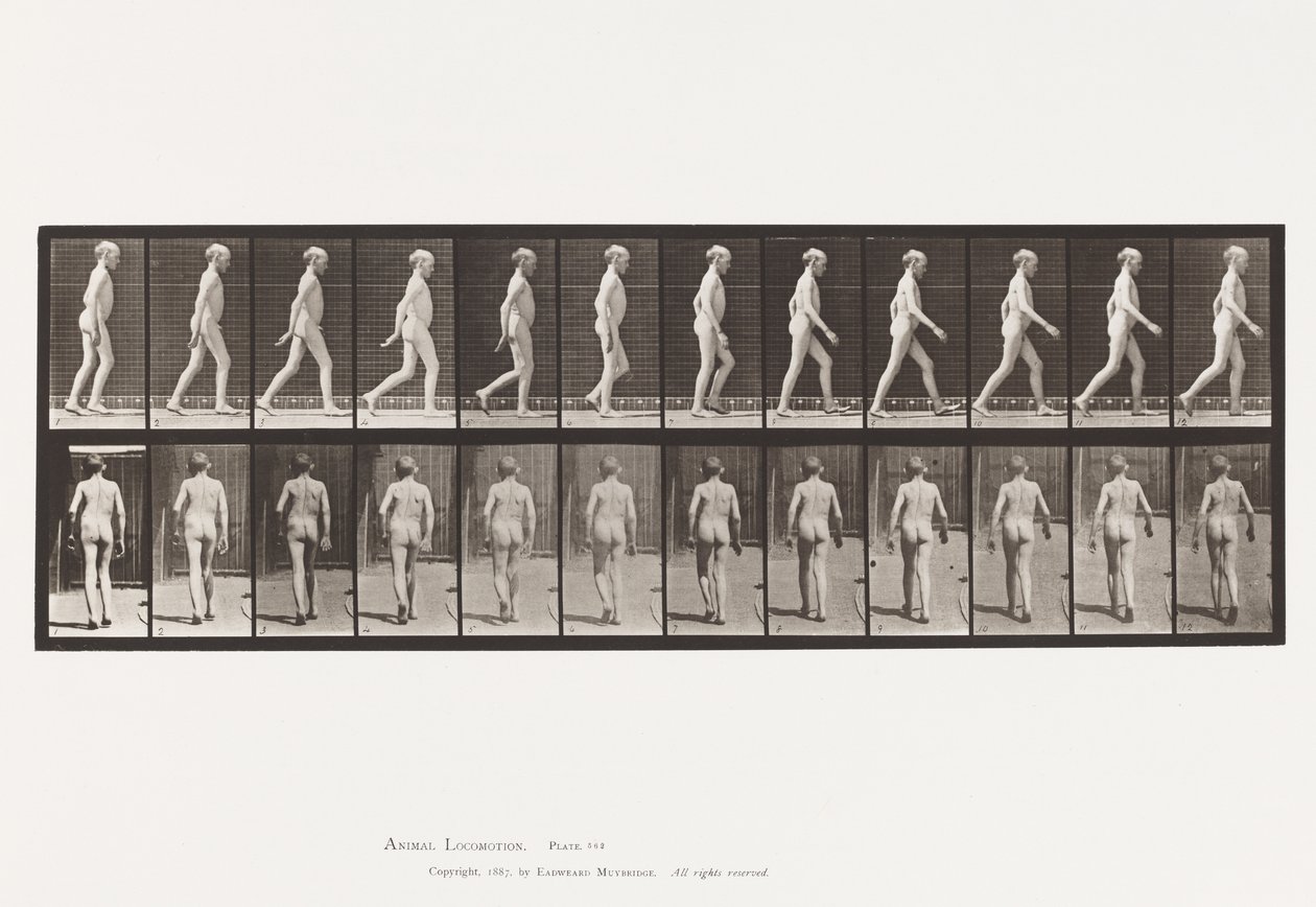 Planche 562. Courbure Latérale de la Colonne Vertébrale; Marche - Eadweard Muybridge