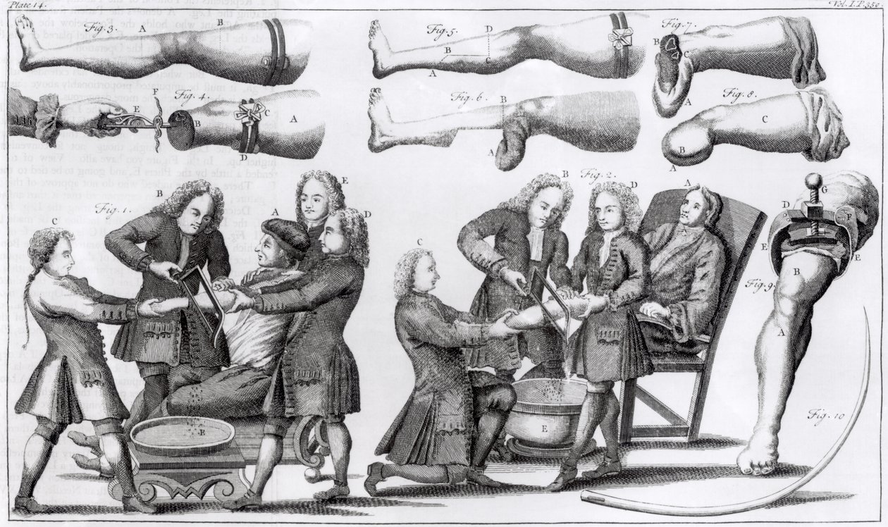 Opérations chirurgicales sur les membres - English School