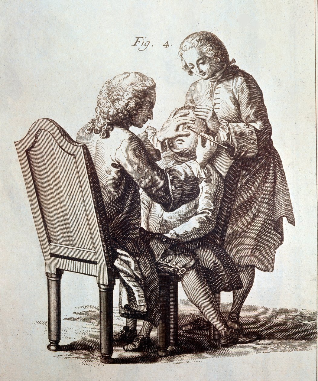 Un médecin opérant un patient atteint de cataracte, illustration de l