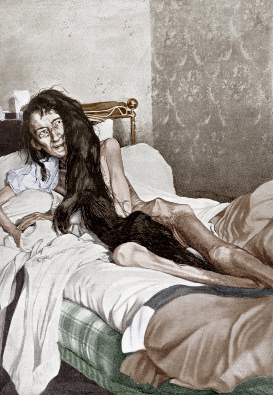 Blanche Monnier in hospital, Poitiers, June 1901 (print) - French School