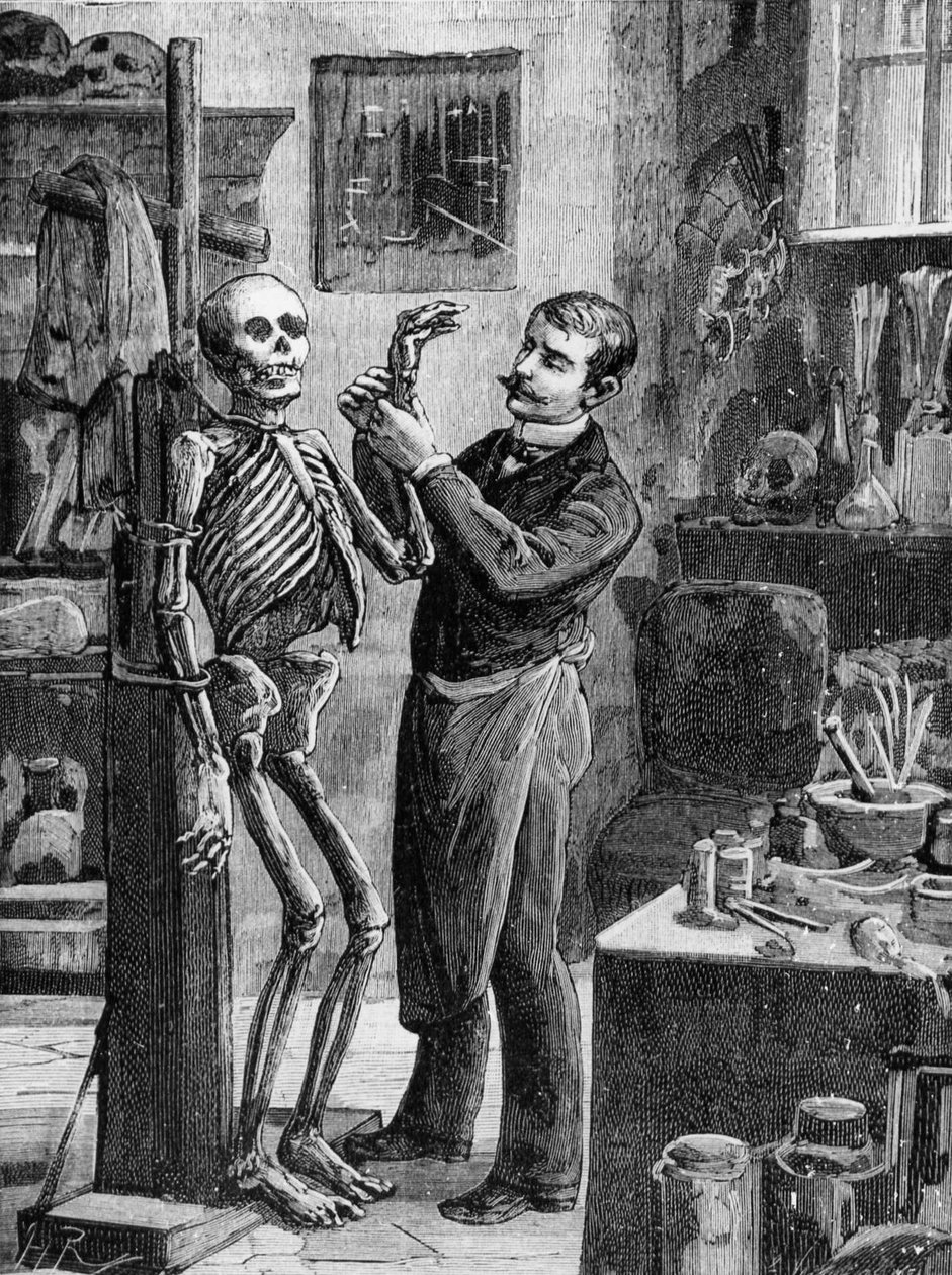 Affaire Gouffé : La reconstruction imaginaire du cadavre Gouffé par le Dr Lacassagne - dans « La Malle Sanglante » - French School