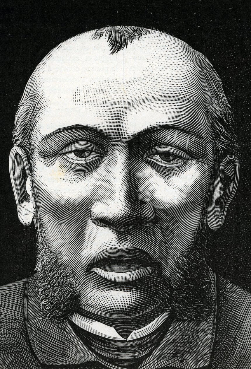 Patient avec ramollissement cérébral (gravure) 1888 - French School