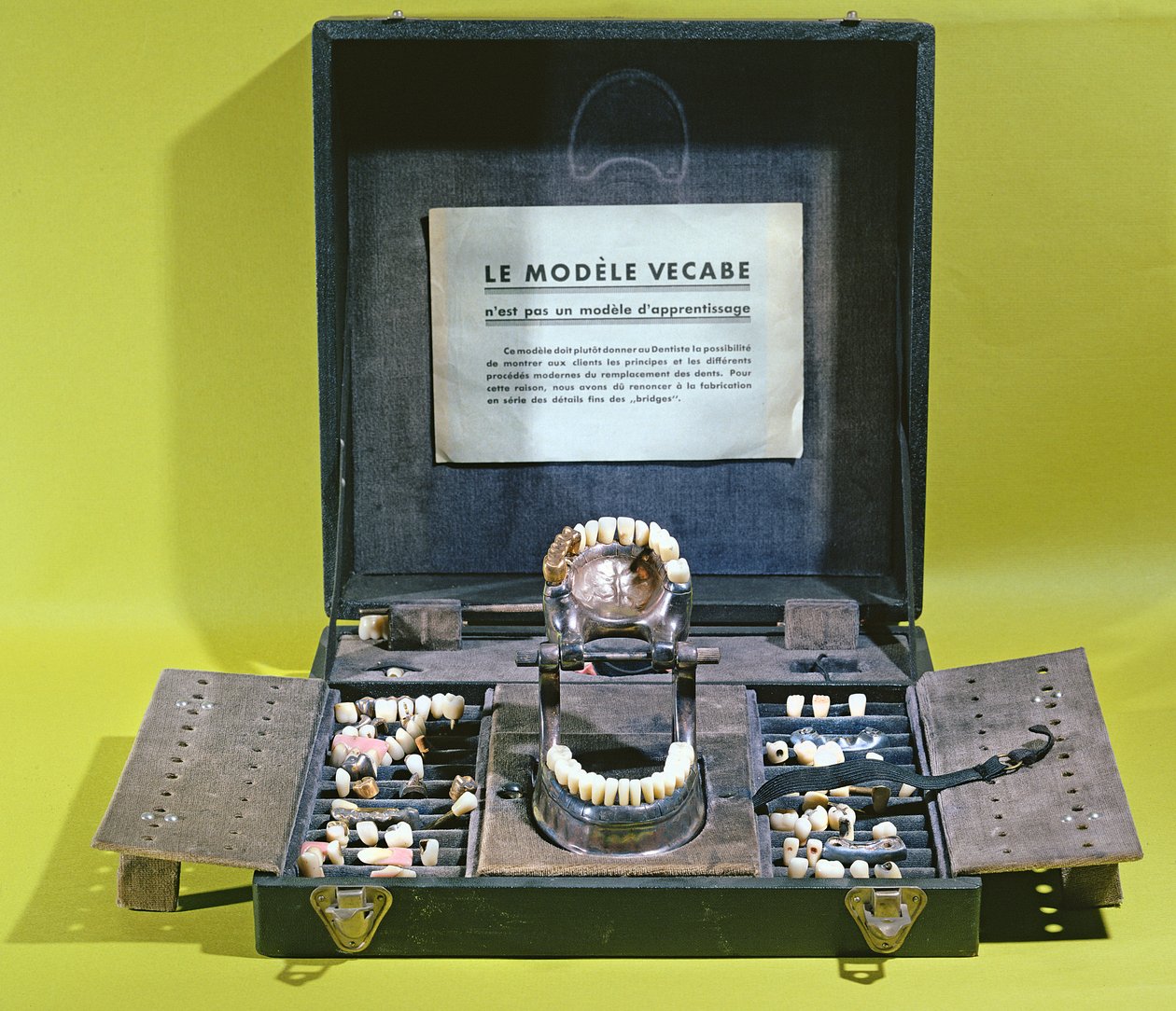Le modèle Vecabe, pour faire des couronnes et des ponts - French School