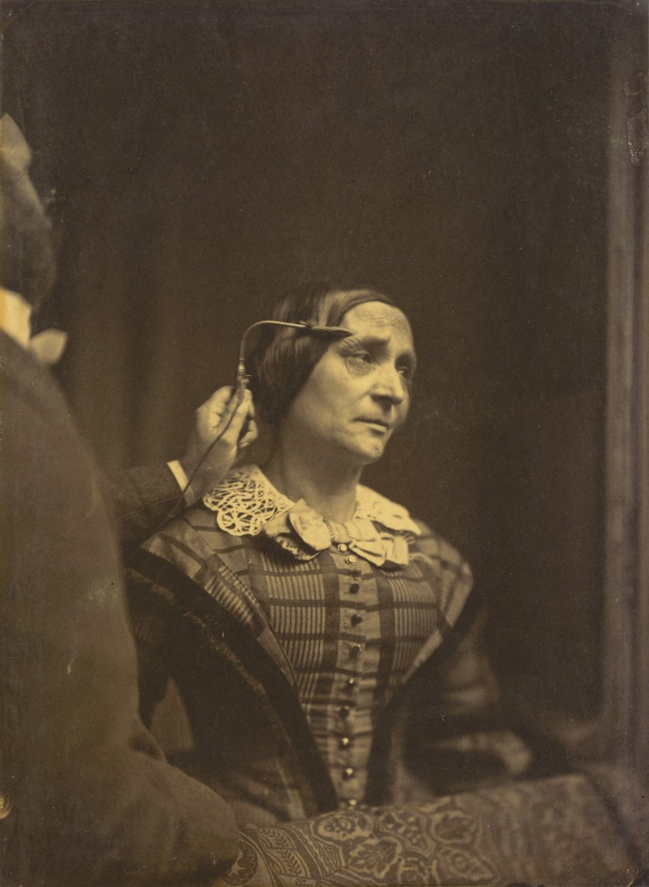 Attention, regard attentif (à gauche) ; Attention douloureuse (à droite),1854-1856, imprimé en 1862 (photo) - Guillaume-Benjamin-Armand Duchenne de Boulogne
