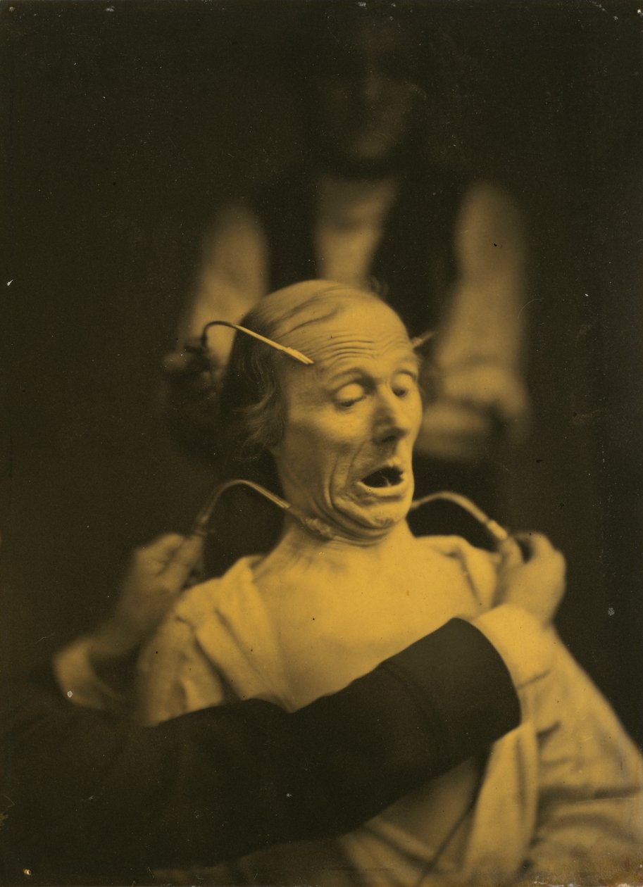 Expression de la terreur, 1854-1856, imprimé en 1862 (photo) - Guillaume Benjamin Armand Duchenne de Boulogne
