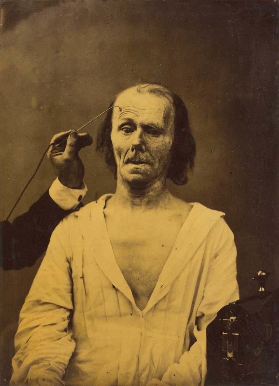 Visage détendu (gauche); Attention profonde (droite) - Guillaume Benjamin Amant Duchenne