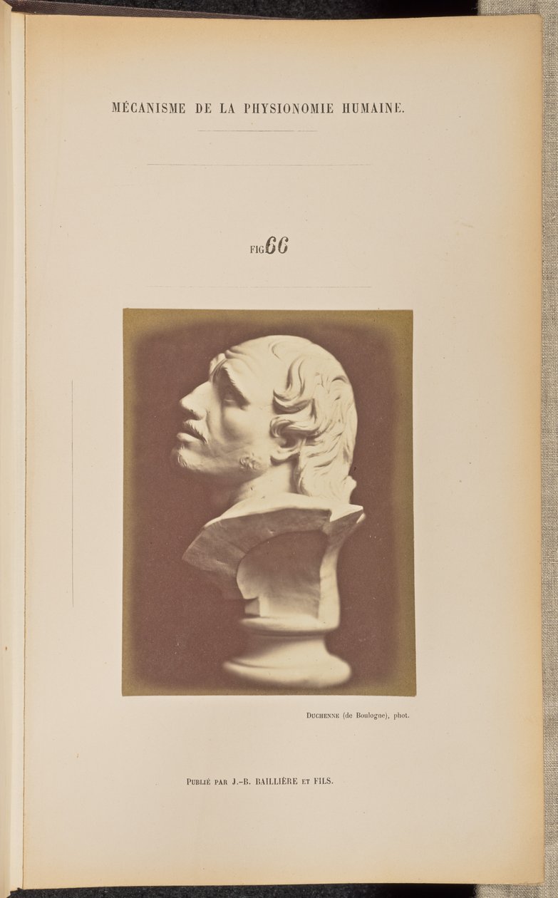 Fig. 66 - Guillaume-Benjamin Duchenne