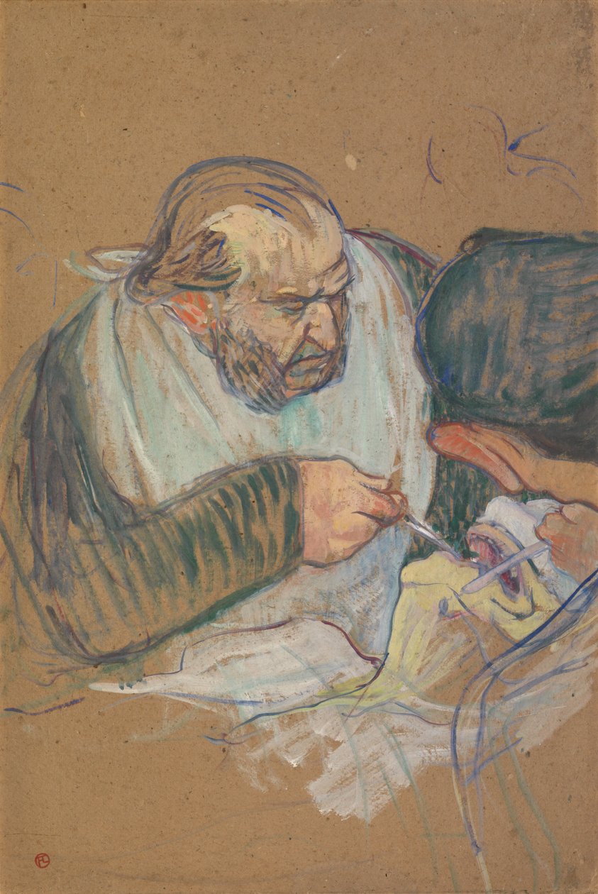 Le Dr Péan opérant - Henri de Toulouse-Lautrec