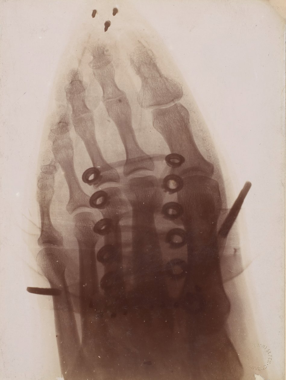 Le pied à travers la chaussure, 1896 - Henri van Heurck