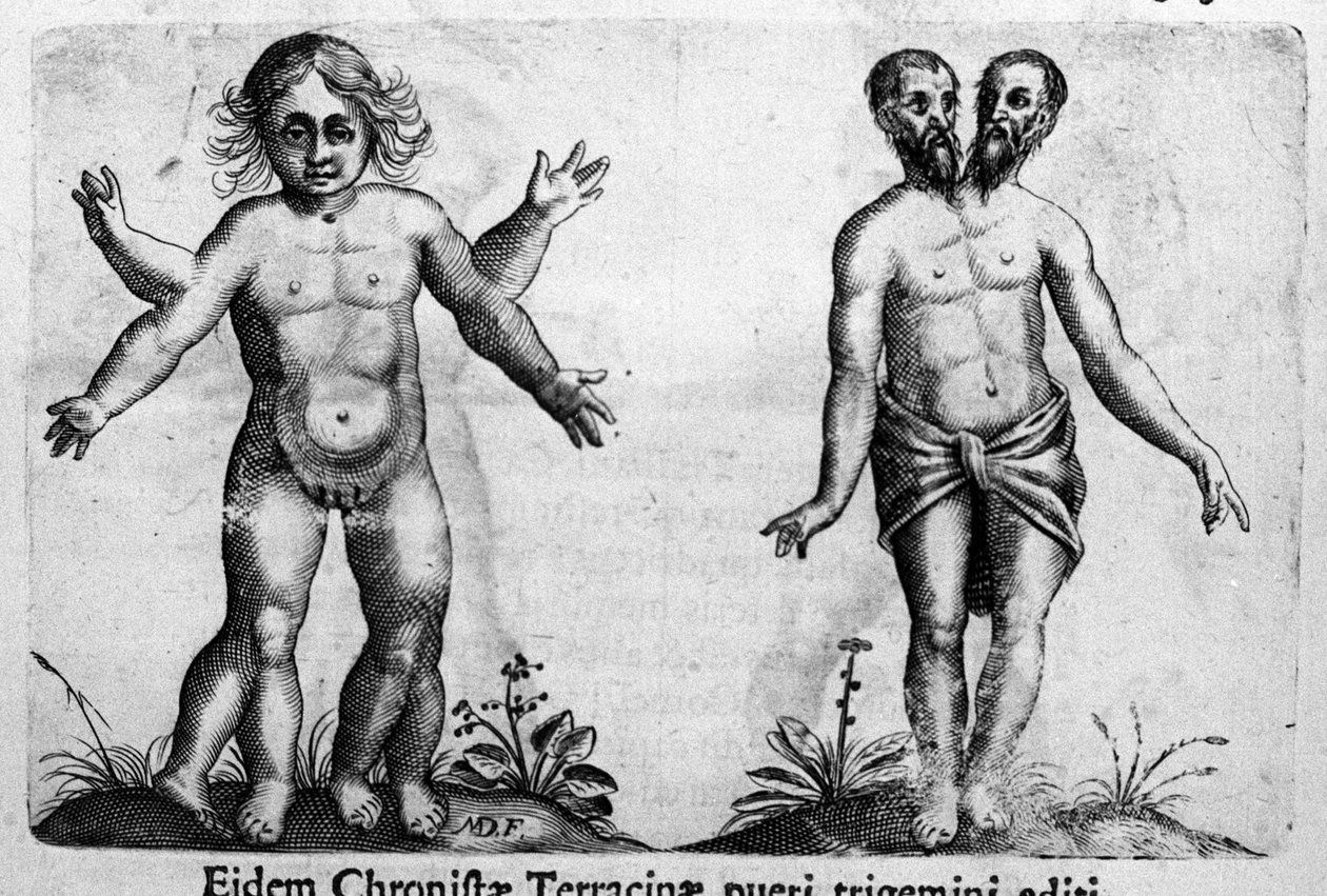 Différents types de monstres humains. Gravure tirée de « De monstrorum natura, causis et differentiis » par Fortunio Liceti (1577-1656), scientifique italien. 1646 - Italian School