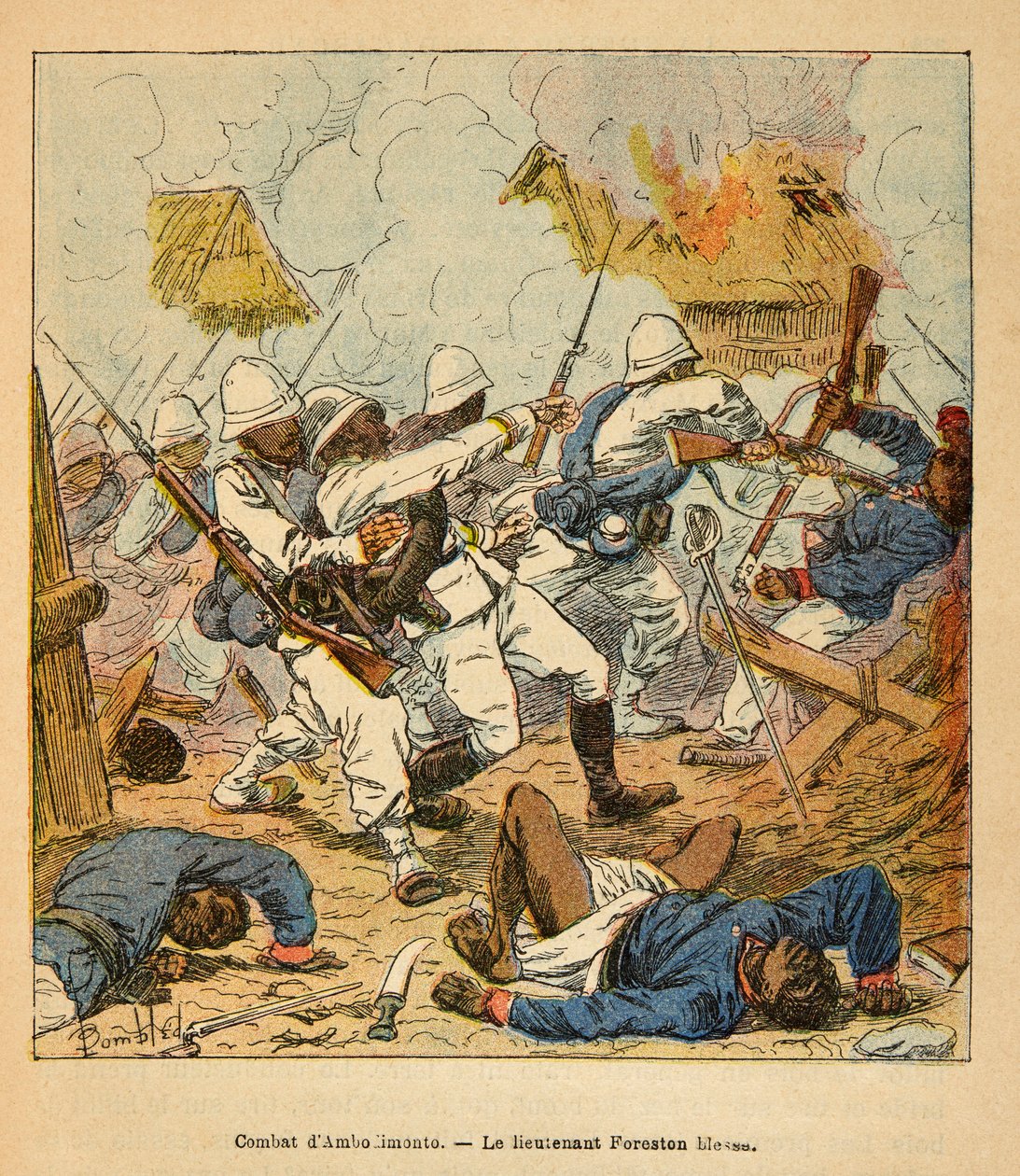 La guerre à Madagascar - Histoire anecdotique des expéditions françaises de 1885-1895 par Henri Galli dit Galllichet (1854-1922), illustrée par Louis Bombled (1862-1927) : Lieutenant Foreston blessé lors des batailles d