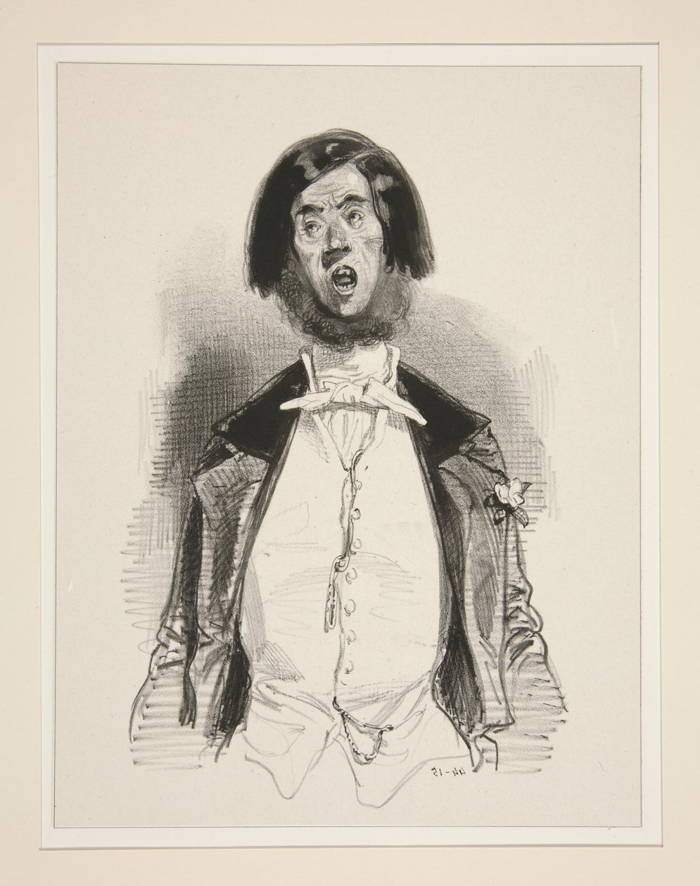 La douleur d