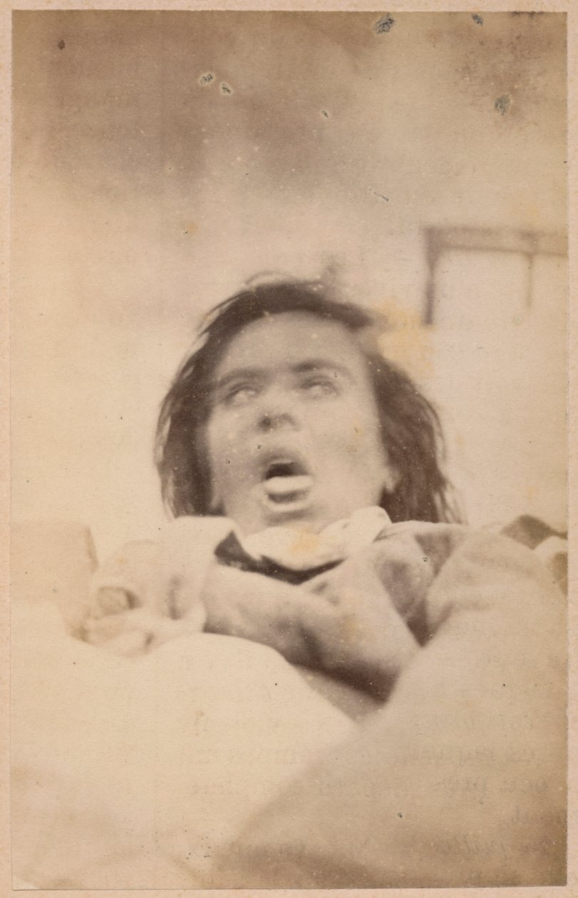 Épilepsie hystérique, hallucinations, angoisse, planche XXIX de 