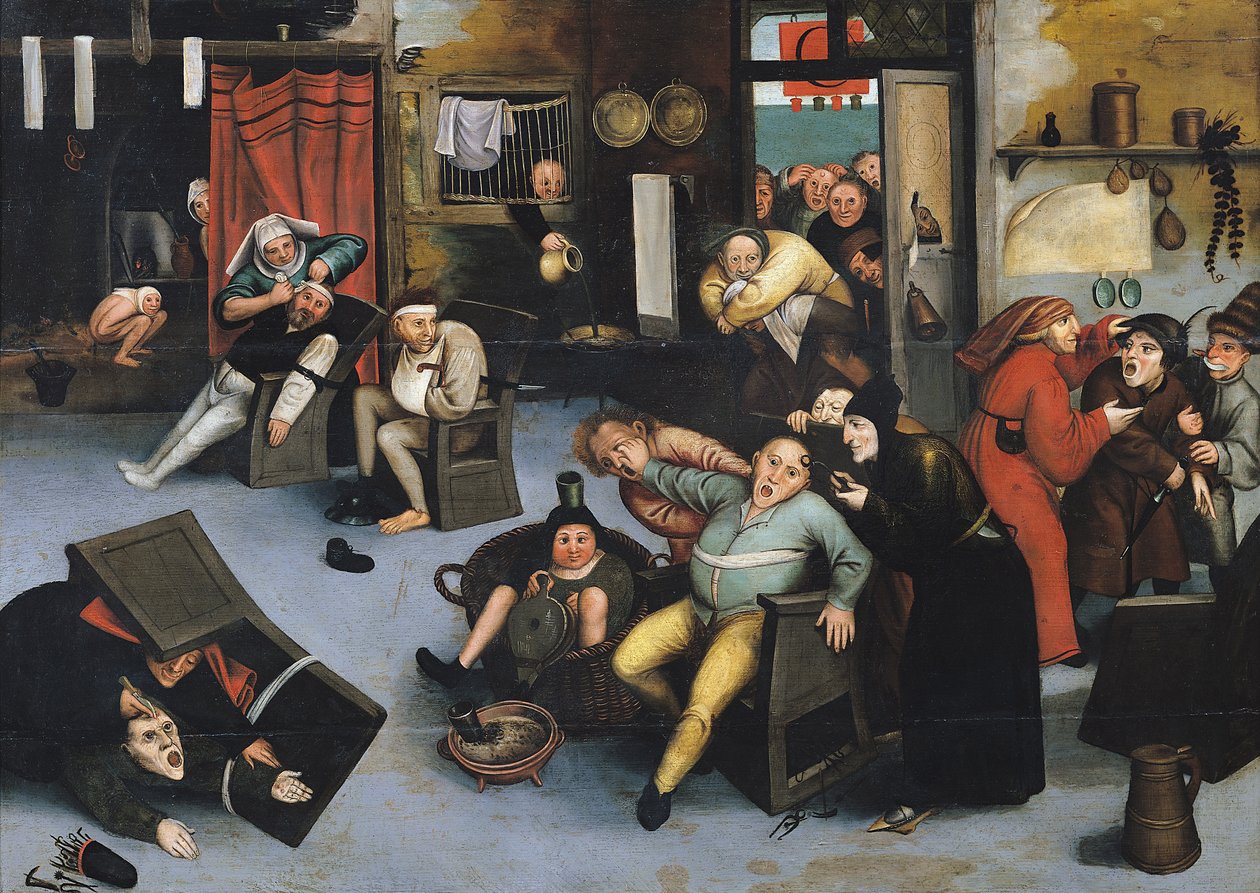 Extraction de la pierre de folie ou opération sur la tête - Pieter Bruegel the Elder