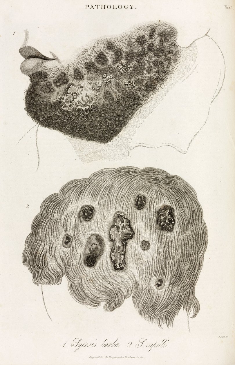 Dermatologie Maladies de la peau - John Pardon