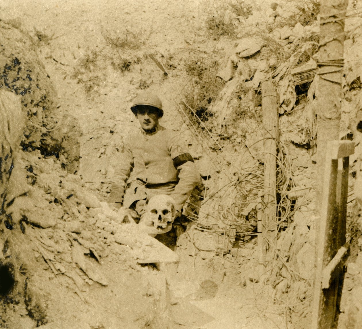 Crâne trouvé enterré dans les tranchées, vers 1914-1918 - Unbekannt