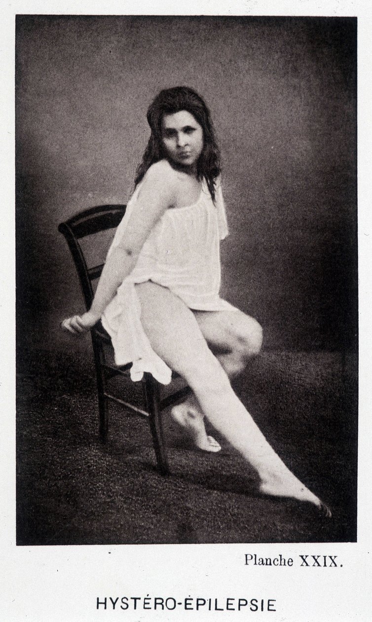 Hystéro-épilepsie - Contracture dans « Iconographie photographique de la Salpêtrière : service de M. Charcot » par Paul Regnard et Bourneville - Unknown artist