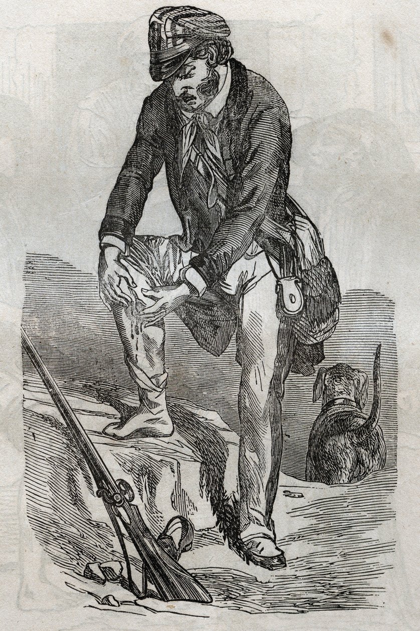 Rage - traitement des morsures faites par un animal enragé - blessé pressant sa plaie - gravure dans "La Santé Universelle - Guide Médical des Familles" 1852 - Unknown artist