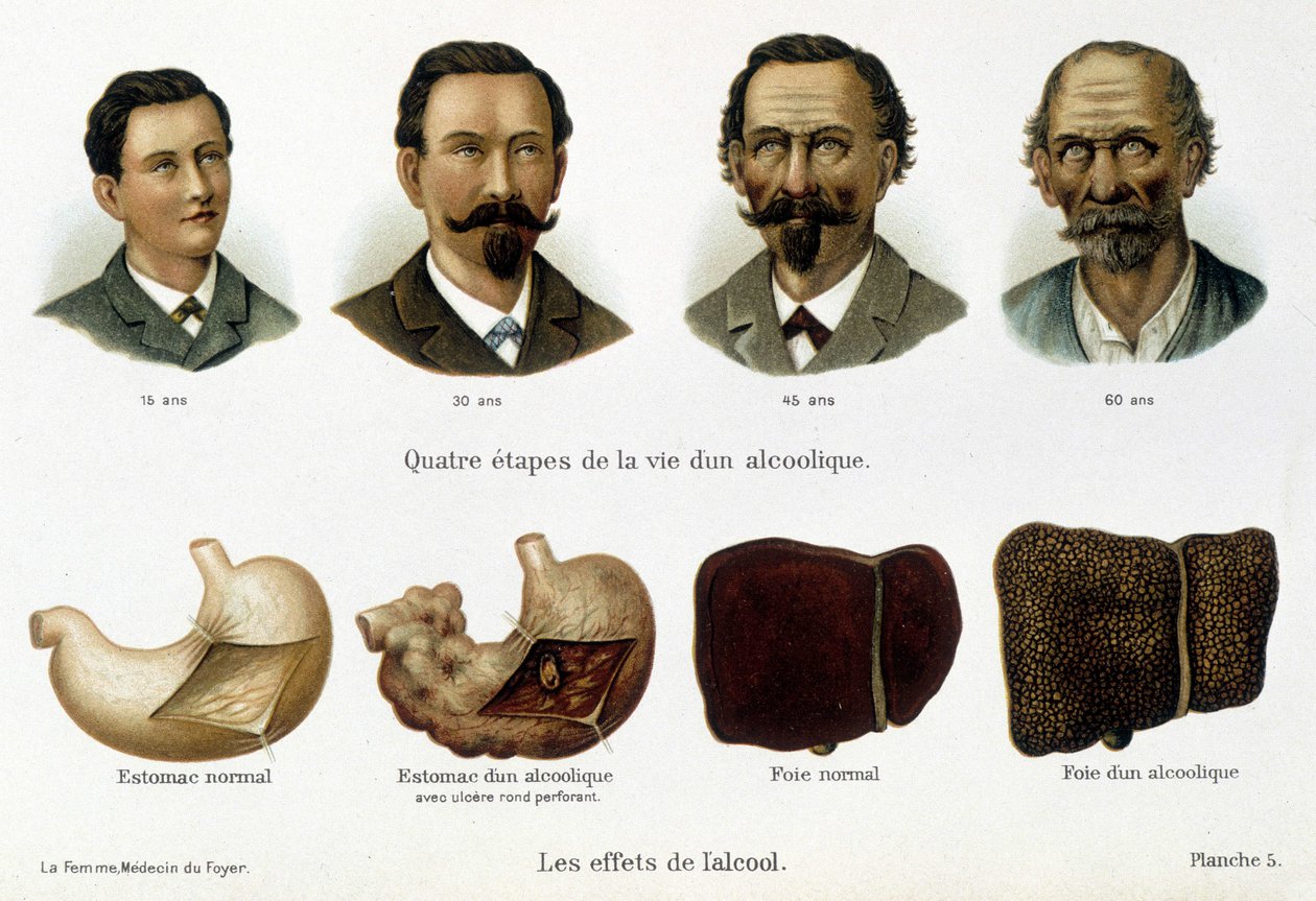 Les effets de l