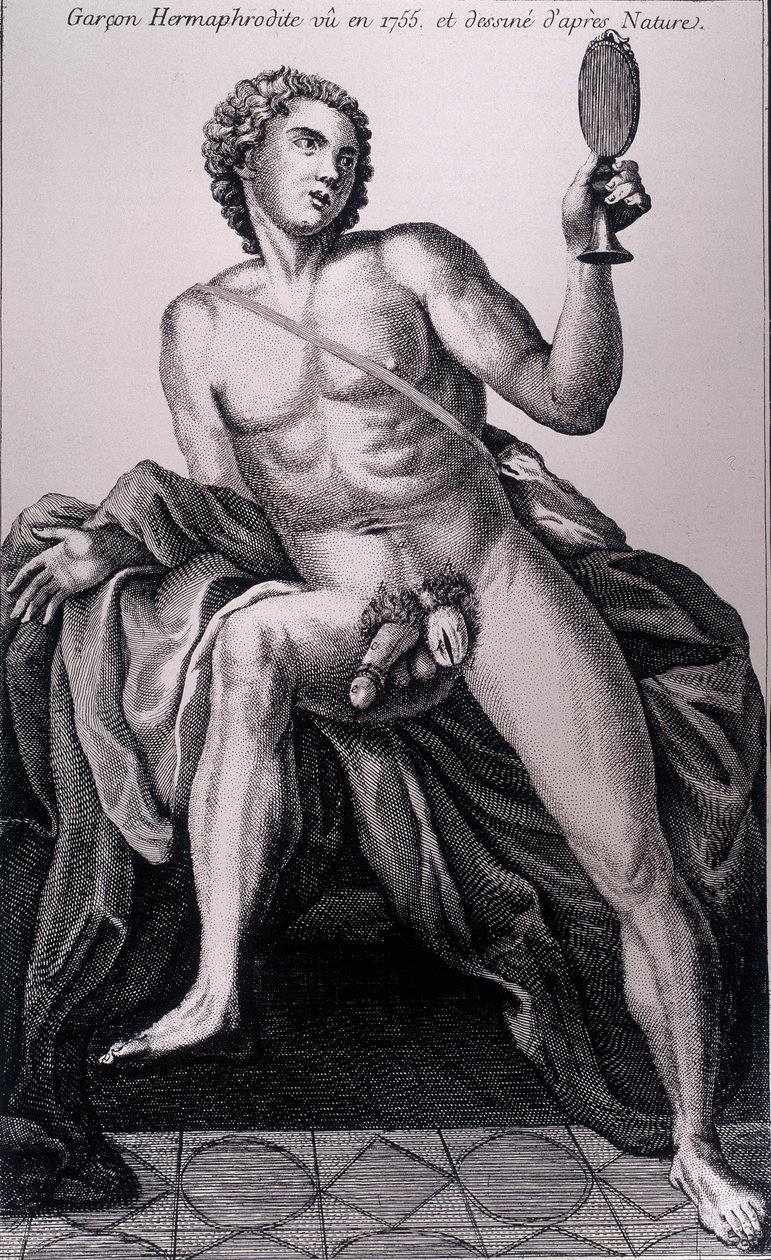Garçon hermaphrodite vu en 1755 et dessiné d
