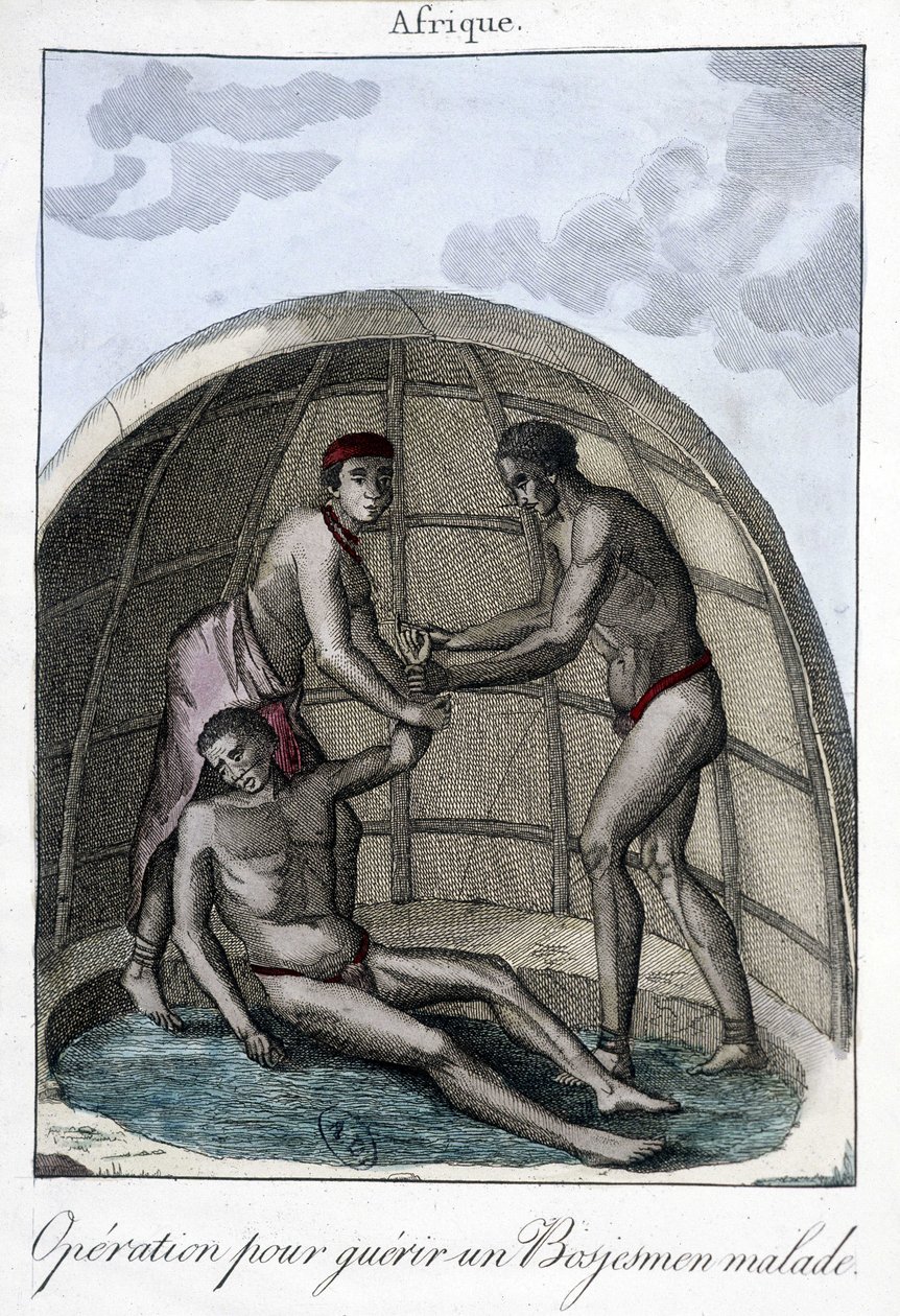 Opération pour soigner un Bojesmen - gravure - Unknown artist