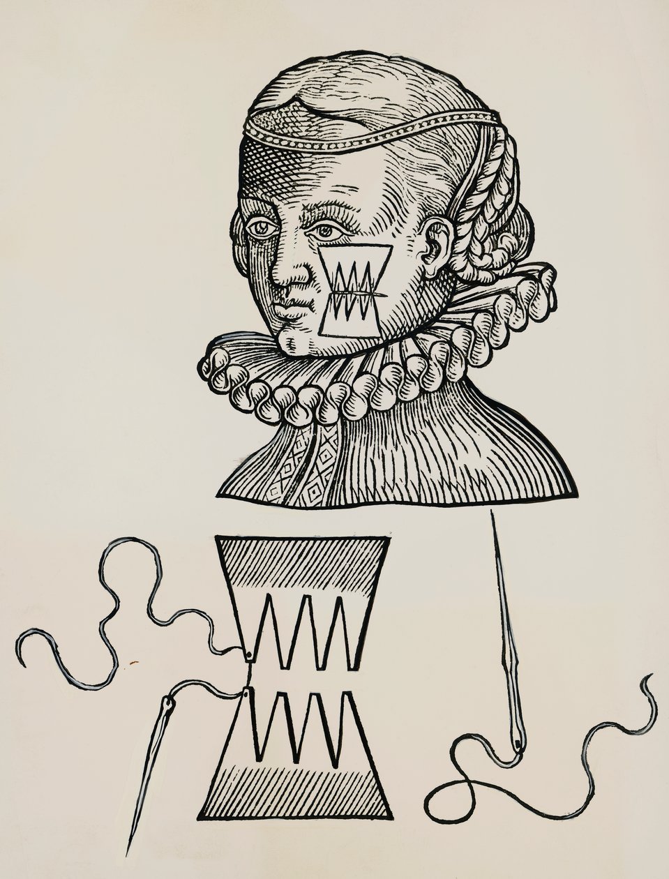 Blessure à la joue traitée avec des pansements pour éviter les traces de points de suture - Unknown artist