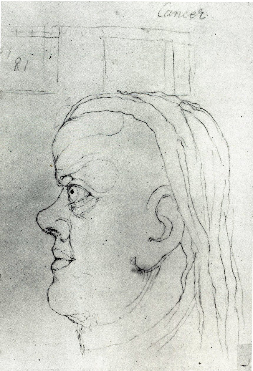 Tête de Cancer - William Blake