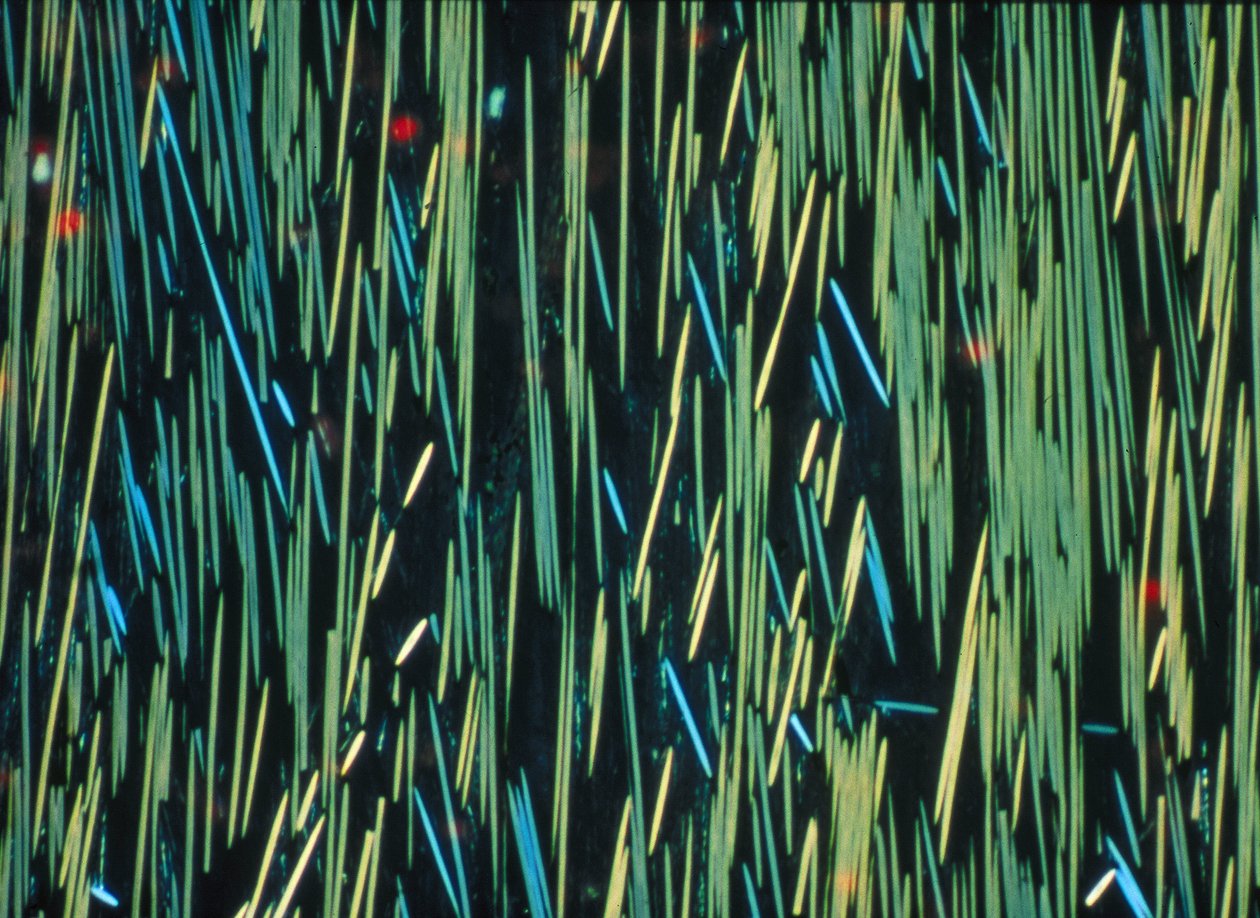 Composite, fibre de carbone PMC dans une matrice polymère - Frederick (attr. to) Barnard