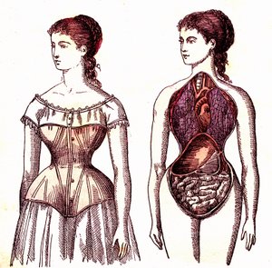 Compression du corset - La Vie Normale et Santé par J. Rengade. Dessin de A. Demarle 1881 - Alphonse Demarle