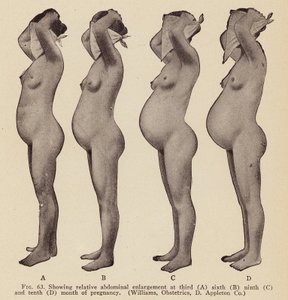 Signes et symptômes de la grossesse (photo n/b) - American Photographer
