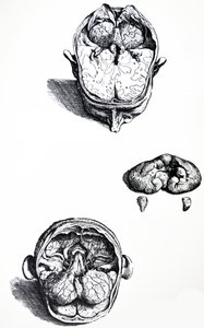 Les planches du septième livre de De Humani Corporis Fabrica