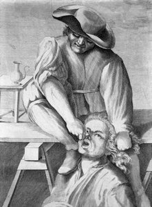 Le tireur de dents (gravure, 18e siècle)