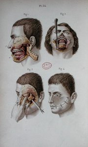 Planche anatomique de la mâchoire supérieure - C and Huette E. Bernard