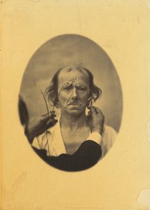 Insatisfaction, pensées sombres à gauche, réflexion à droite, 1854-1856, imprimé en 1862 - Duchenne de Boulogne