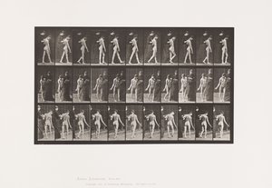 Planche 541. Sclérose Cérébro-Spinale Multiple (Choréique); Marche