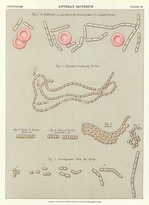 Bactérie du charbon