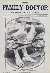 Bottes serrées et pieds déformés - English School