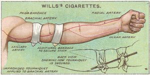 Garrot, no.11 de la série Premiers Secours des cartes de cigarettes Willss, 1913 - English School