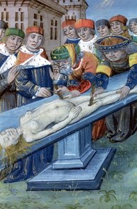 Dissection, de De Medina Fen I. II, par Avicenne