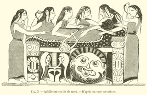 Achille sur son lit de mort - French School