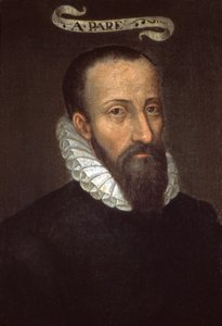 Ambroise Paré. XVIe siècle