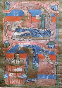 Femme hydropique guérie par les bains de Sainte Radegonde, de La Vie de Sainte Radegonde - French School