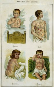 Planche illustrant les maladies infantiles : urticaire, gale, scarlatine et rougeole (tirée de Bilz, médication naturelle) fin du XIXe siècle